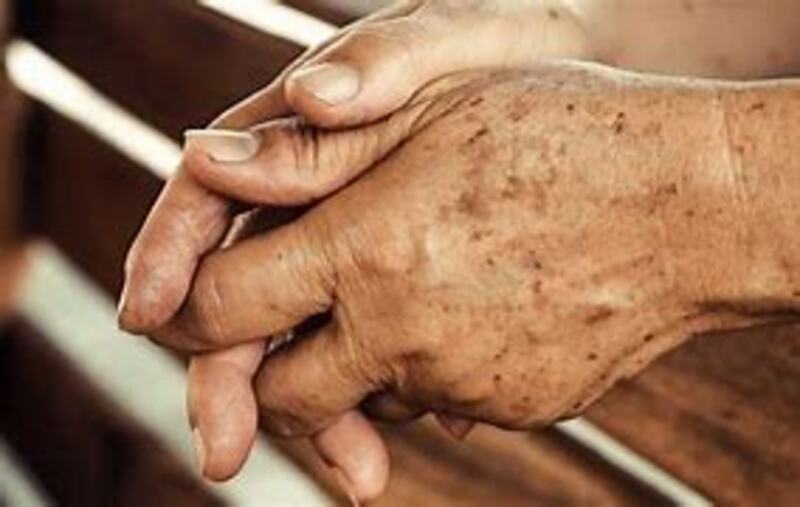 What Is The Meaning Of liver spotted Hand Question About English what-is-the-liver
