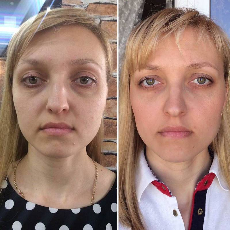 Лица отзывы. Массаж лица фото до и после реальные. Упражнения для лица до и после. Фейсбилдинг для носа до и после. Фейсбилдинг до и после реальные.