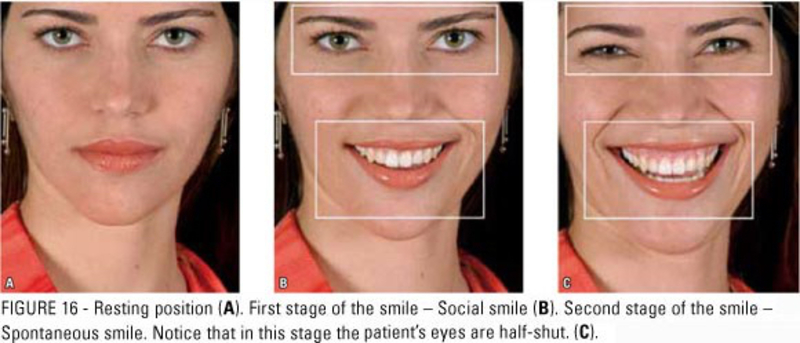 what-is-the-difference-between-grin-and-smile-grin-vs-smile