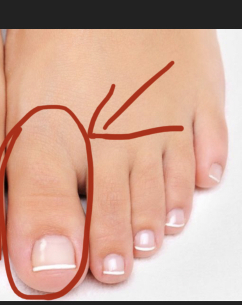 "big toe"是什么意思-关于英语(美国 hinative