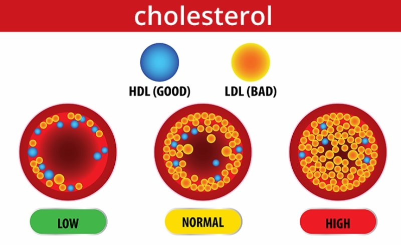 cholesterol是什么意思